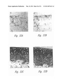 ANTI-ANGIOGENIC COMPOSITIONS AND METHODS OF USE diagram and image