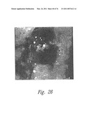 ANTI-ANGIOGENIC COMPOSITIONS AND METHODS OF USE diagram and image