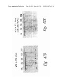 ANTI-ANGIOGENIC COMPOSITIONS AND METHODS OF USE diagram and image