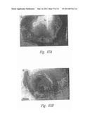 ANTI-ANGIOGENIC COMPOSITIONS AND METHODS OF USE diagram and image