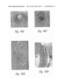 ANTI-ANGIOGENIC COMPOSITIONS AND METHODS OF USE diagram and image