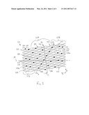 Stent With Improved Flexibility diagram and image