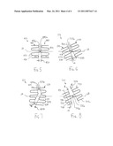 Stent With Improved Flexibility diagram and image