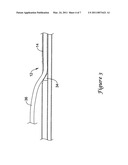 Rapid Exchange Stent Delivery System diagram and image