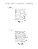 VALVE APPARATUS, SYSTEM AND METHOD diagram and image