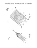 VALVE APPARATUS, SYSTEM AND METHOD diagram and image