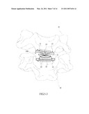 Displacement Leaf Spring and Artificial Intervertebral Disc Containing the Same diagram and image