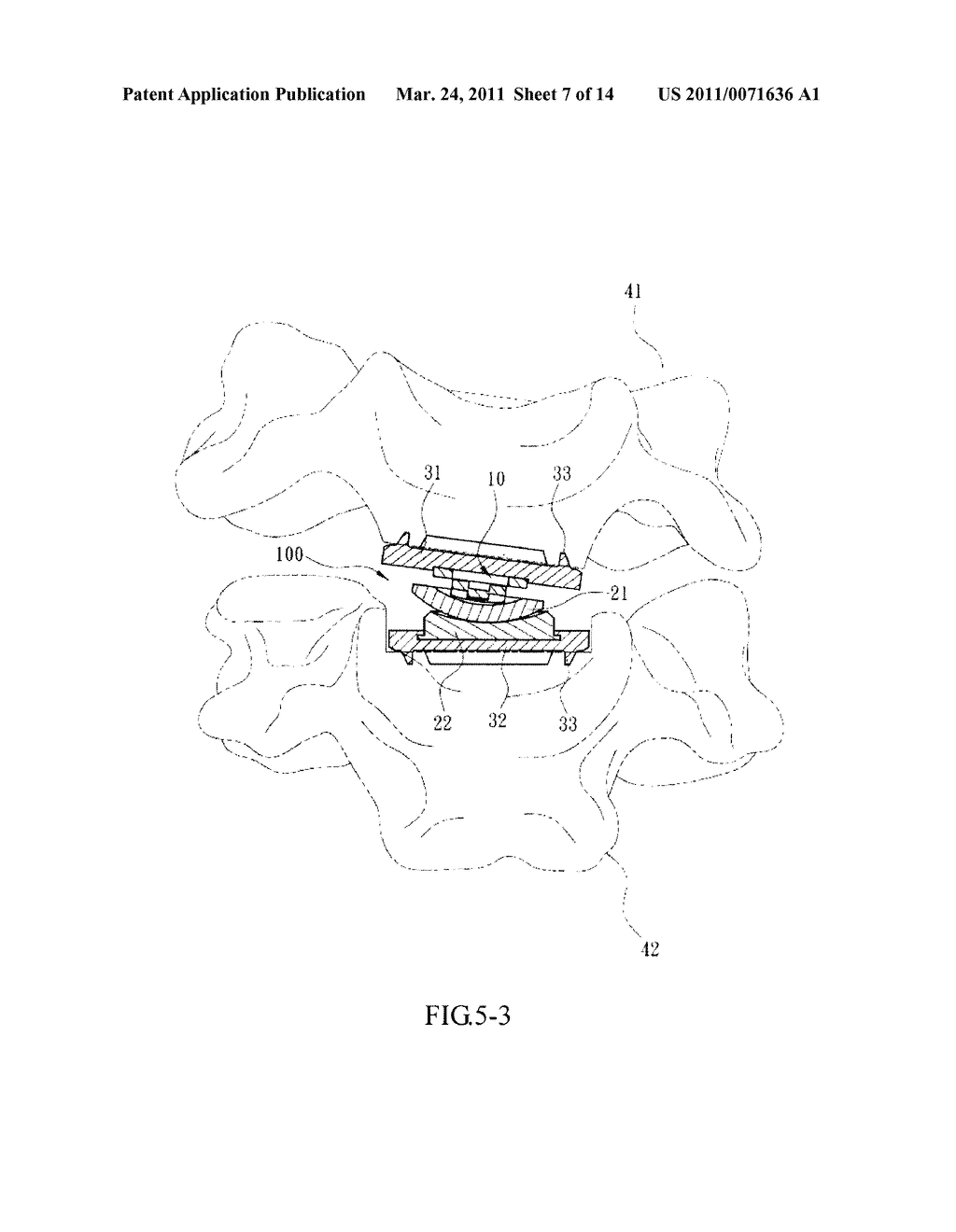 Displacement Leaf Spring and Artificial Intervertebral Disc Containing the Same - diagram, schematic, and image 08