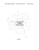 Displacement Leaf Spring and Artificial Intervertebral Disc Containing the Same diagram and image