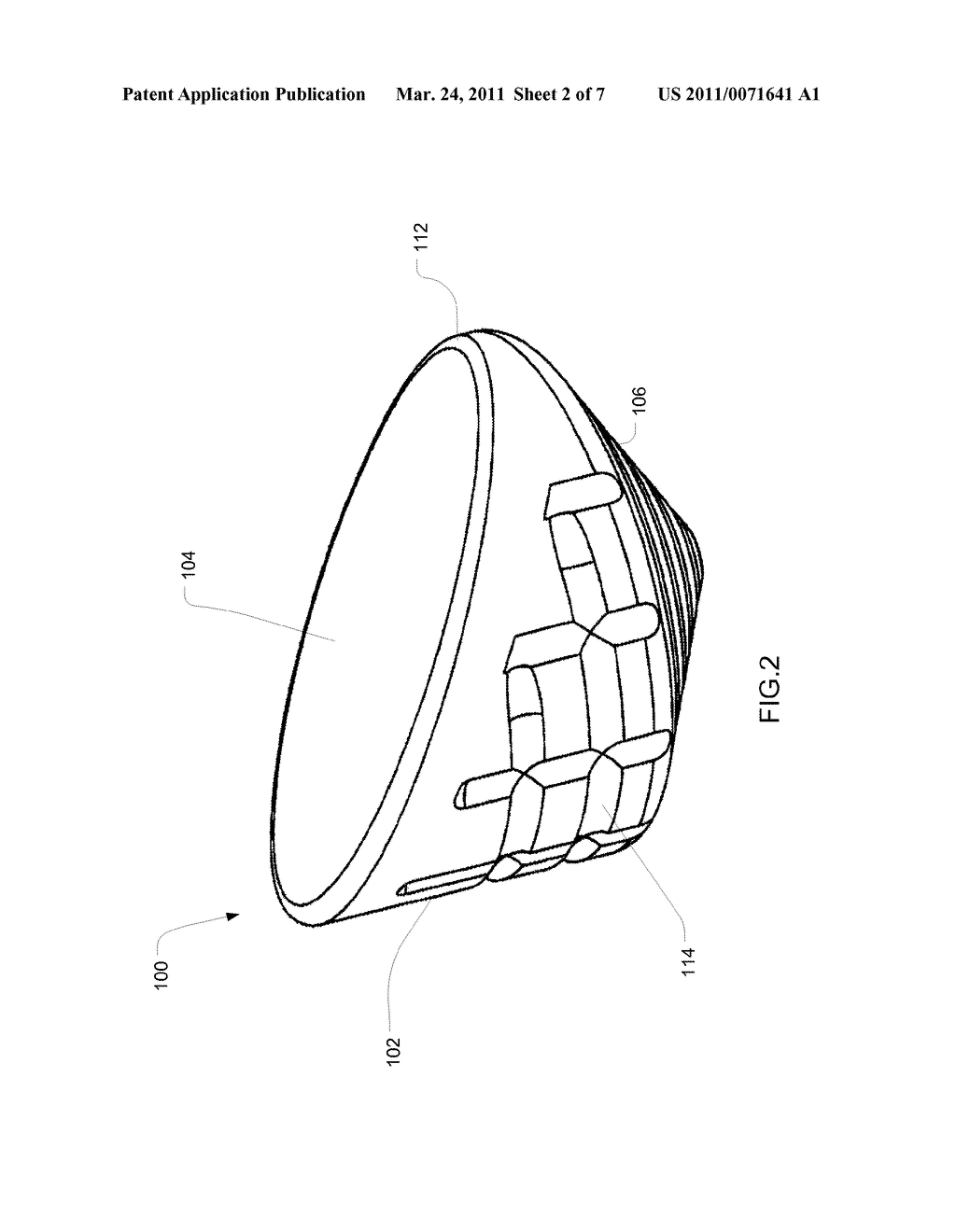 Articular Surface Implant and Delivery System - diagram, schematic, and image 03