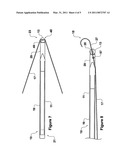 HOOK REMOVAL TOOL diagram and image