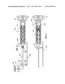 Selectively Coating Luminal Surfaces of Stents diagram and image