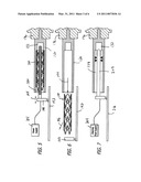 Selectively Coating Luminal Surfaces of Stents diagram and image