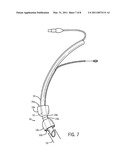 TRACHEAL CUFF FOR PROVIDING SEAL WITH REDUCED PRESSURE ON THE TRACHEAL WALLS diagram and image