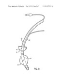 TRACHEAL CUFF FOR PROVIDING SEAL WITH REDUCED PRESSURE ON THE TRACHEAL WALLS diagram and image