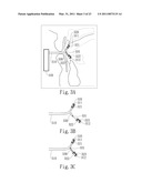 NEGATIVE PRESSURE ORAL APPARATUS diagram and image