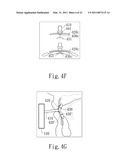 NEGATIVE PRESSURE ORAL APPARATUS diagram and image