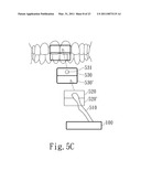 NEGATIVE PRESSURE ORAL APPARATUS diagram and image