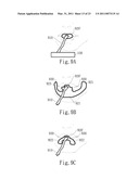 NEGATIVE PRESSURE ORAL APPARATUS diagram and image