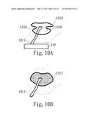 NEGATIVE PRESSURE ORAL APPARATUS diagram and image