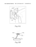 NEGATIVE PRESSURE ORAL APPARATUS diagram and image