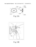 NEGATIVE PRESSURE ORAL APPARATUS diagram and image