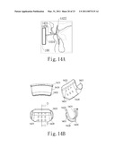 NEGATIVE PRESSURE ORAL APPARATUS diagram and image