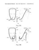 NEGATIVE PRESSURE ORAL APPARATUS diagram and image