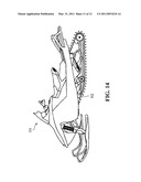 Noiseless Elastomeric Tracks For Tracked Vehicles diagram and image