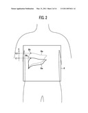 MAGNETIC RESONANCE IMAGING APPARATUS AND METHOD diagram and image