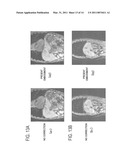 MAGNETIC RESONANCE IMAGING APPARATUS AND METHOD diagram and image