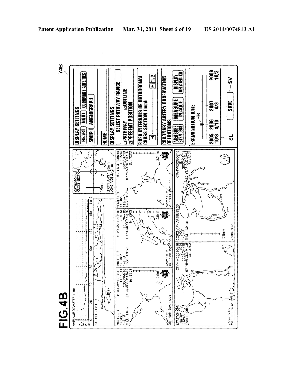 DIAGNOSIS ASSISTING SYSTEM, DIAGNOSIS ASSISTING METHOD, AND COMPUTER READABLE RECORDING MEDIUM HAVING DIAGNOSIS ASSISTING PROGRAM RECORDED THEREON - diagram, schematic, and image 07