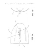 DETACHABLE SIDESHADE FOR SPECTACLES diagram and image