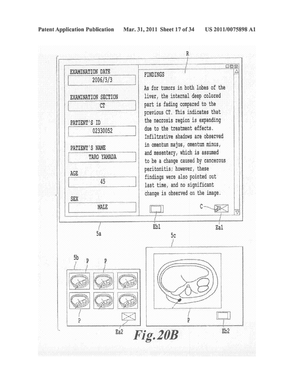 MEDICAL IMAGE INTERPRETING APPARATUS AND CURSOR-MOVING METHOD - diagram, schematic, and image 18