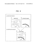 ULTRASONIC IMAGING APPARATUS diagram and image