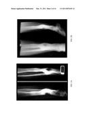 Herbal Formulation for the Treatment of Bone Fractures and Osseous Defects diagram and image