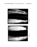 Herbal Formulation for the Treatment of Bone Fractures and Osseous Defects diagram and image