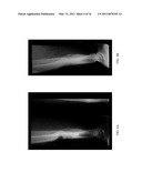 Herbal Formulation for the Treatment of Bone Fractures and Osseous Defects diagram and image