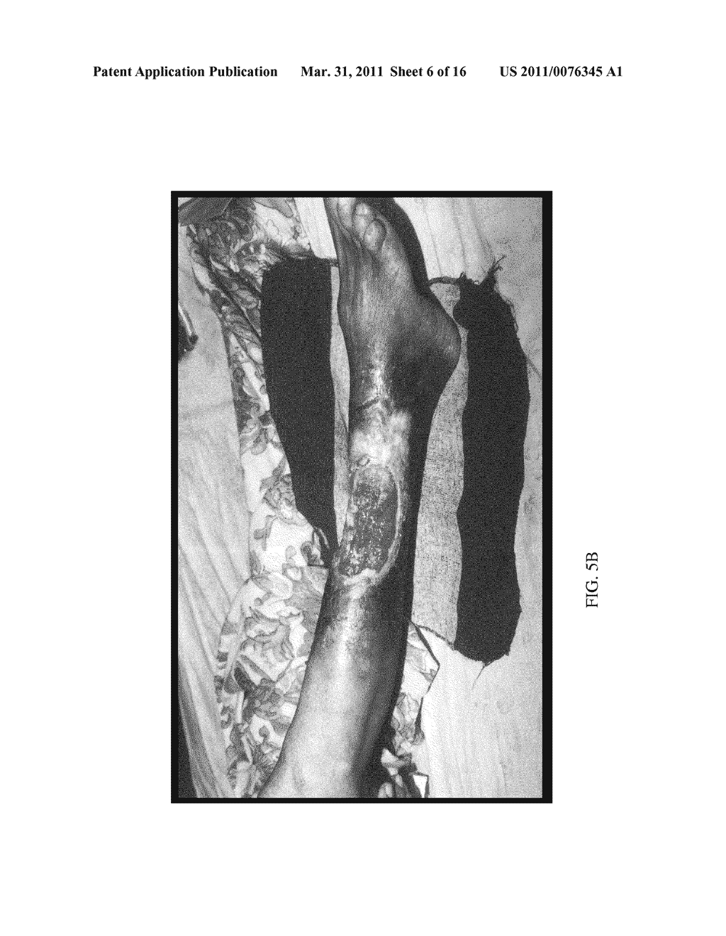 Herbal Formulation for the Treatment of Bone Fractures and Osseous Defects - diagram, schematic, and image 07