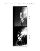 Herbal Formulation for the Treatment of Bone Fractures and Osseous Defects diagram and image