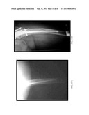 Herbal Formulation for the Treatment of Bone Fractures and Osseous Defects diagram and image