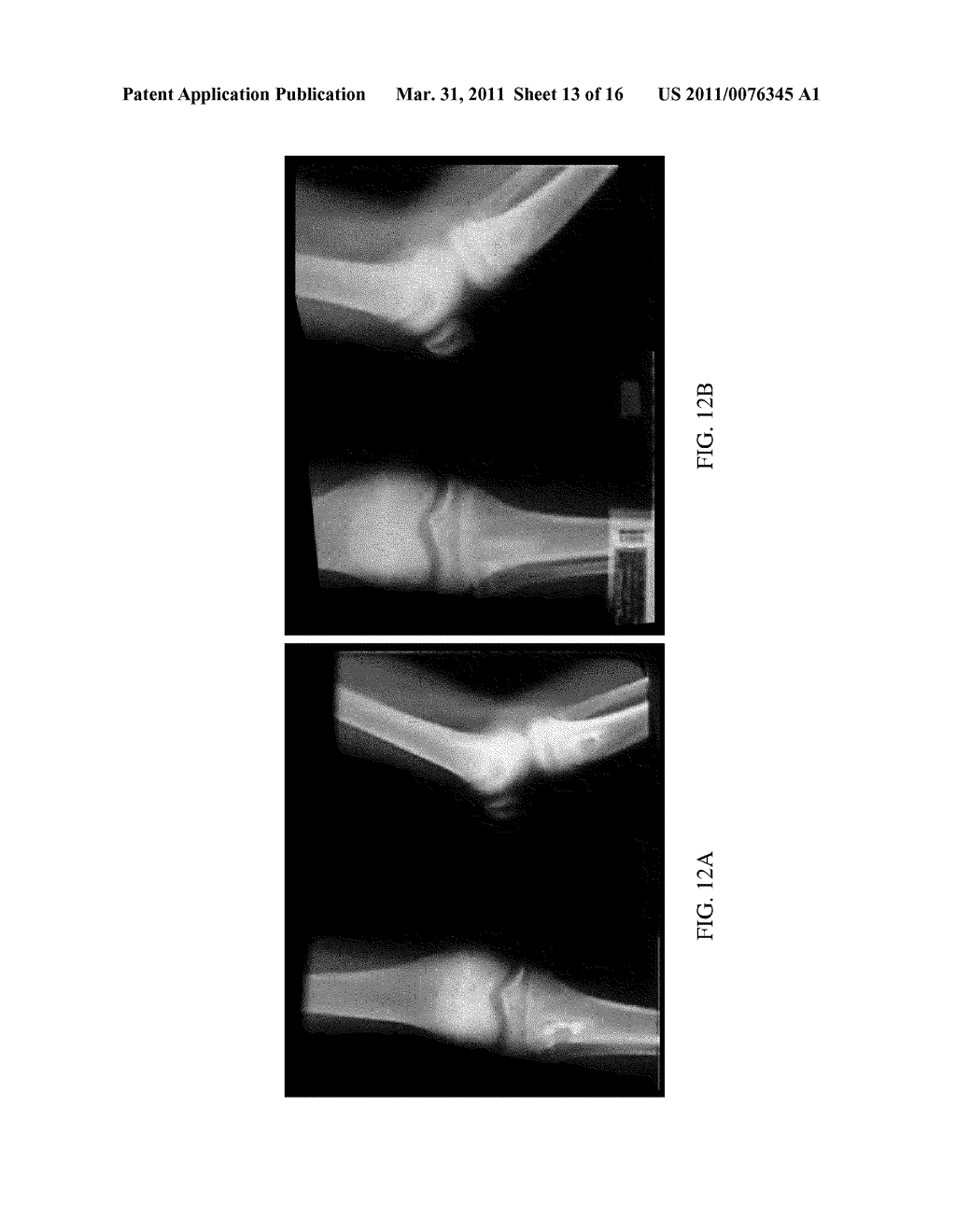 Herbal Formulation for the Treatment of Bone Fractures and Osseous Defects - diagram, schematic, and image 14