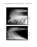 Herbal Formulation for the Treatment of Bone Fractures and Osseous Defects diagram and image