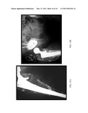 Herbal Formulation for the Treatment of Bone Fractures and Osseous Defects diagram and image