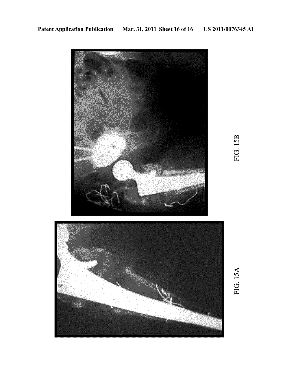 Herbal Formulation for the Treatment of Bone Fractures and Osseous Defects - diagram, schematic, and image 17