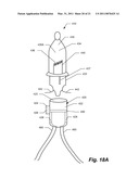 Pull Up Tree System diagram and image