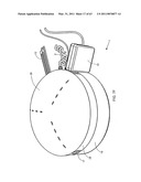 Wall-mountable electrical power supplying device for mounting to a wall surface about a standard wall-mounted power receptacle, using a mounting bracket arranged between the housing and wall surface and an electrical power supply plug integrated with the housing diagram and image