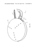 Wall-mountable electrical power supplying device for mounting to a wall surface about a standard wall-mounted power receptacle, using a mounting bracket arranged between the housing and wall surface and an electrical power supply plug integrated with the housing diagram and image