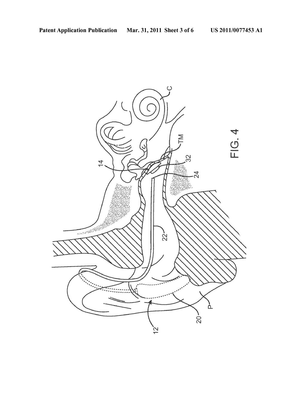 Systems and Methods For Photo-Mechanical Hearing Transduction - diagram, schematic, and image 04