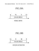 Electronic endoscope system, processor for electronic endoscope, and method of displaying vascular information diagram and image